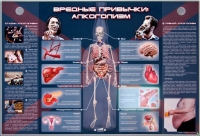 Электрифицированный стенд "Вредные привычки: алкоголизм" - «globural.ru» - Карпинск