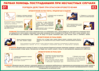 Таблица Порядок действий при опасном кровотечении 1000*1400 винил - «globural.ru» - Карпинск
